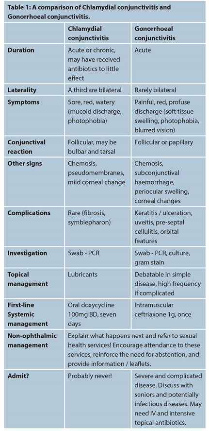 Sexually transmitted conjunctivitis – the REALLY sticky eye | Eye News