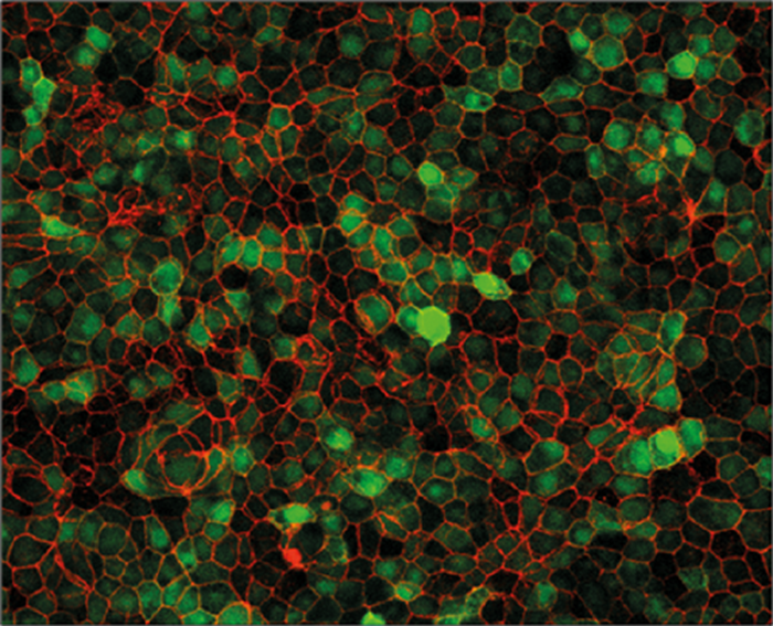 An update on inherited retinal disorders (part 2): Approaches to ...