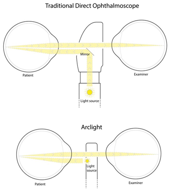 The Arclight A Pocket Ophthalmoscope To Revitalise Undergraduate Teaching Eye News